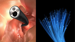TORAY Introduces RAYTELA® Polymer Optical Fiber — Ideal For Minimally Invasive Surgery—Able To Negotiate Tight 9mm Radius Bends