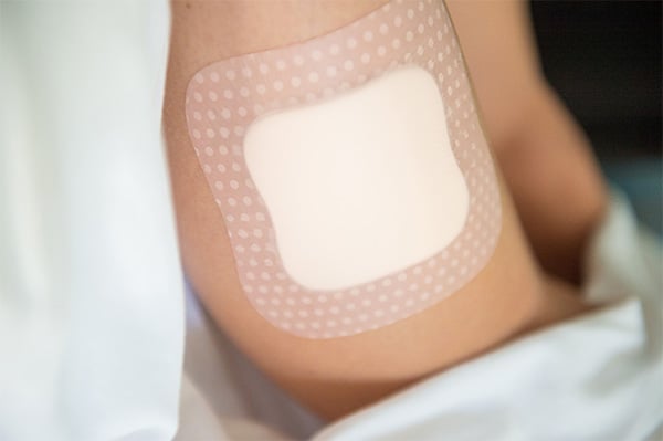 Benefits of Silicones and PU Gel Adhesives for Skin Fixation Applications